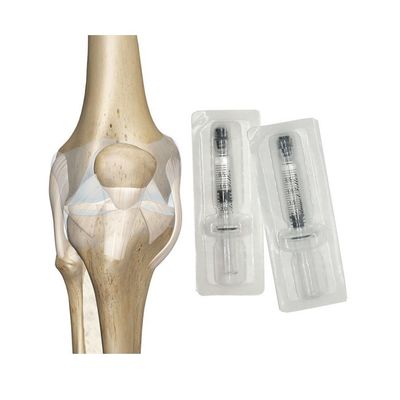 Osteoarthritis Injeksi Gel Hyaluronic Injeksi Hyaluronic Lutut Pelumasan Lutut