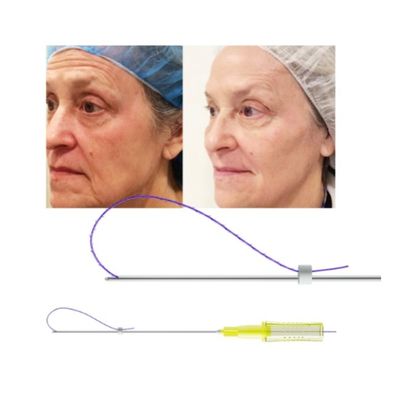 3D 4D 6D PDO Angkat Benang Injeksi Benang Hidung Facelift Mono Tornado Screw