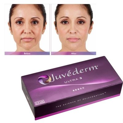 Asam Hyaluronic Juvederm Gel Penuh Wajah Kulit halus dan sempurna