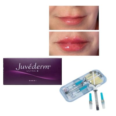 6-9 Bulan Durasi Juvederm Dermal Filler Gel Untuk Dibeli Online Dan Di Toko