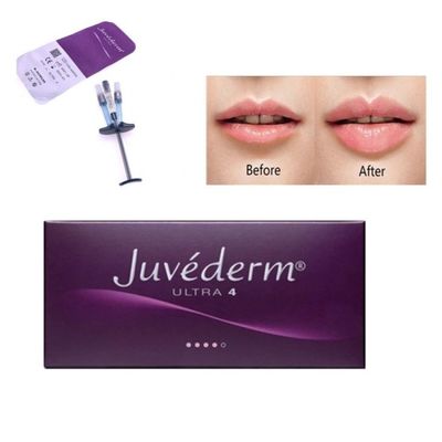 Allergan Juvederm Dermal Filler Injection Ultra4 Dengan Lido