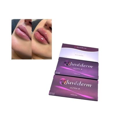 Injeksi Juvederm Voluma Cross Linked Dermal Filler