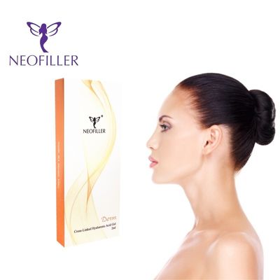 1 ml 2 ml Neofiller HA Filler Kulit Untuk Lifting Wajah Dan Pengobatan Kerutan 9-12 Bulan