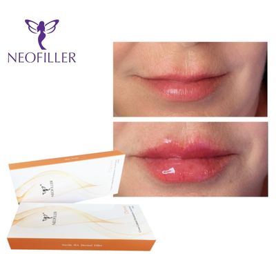 24mg-ml 2ml Syringe Derm Hyaluronic Acid Dermal Filler Injectable Gel Rejuvenation Facial Enhancement