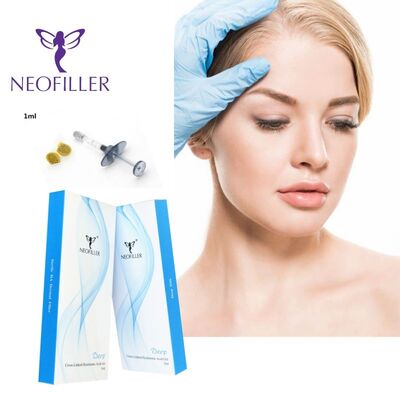 Neofiller 24mg-ml Hyaluronic Acid Dermal Filler Transparent Injectable Gel 9-12 Bulan Peningkatan umur panjang