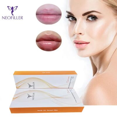 Asam Hyaluronic yang Terkait Saling Pengisi Kulit Peremajaan Wajah Gel Injeksi Regenerasi Kulit Alami Peningkatan