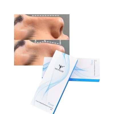 Hyaluronic Acid Dermal Filler 2ml yang terikat silang Deep Line Nose Contour Injectable Gel Perbaikan Wajah