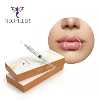 Neofiller Hyaluronic Acid Dermal Filler Wajah Bibir Hidung pipi Gel suntik Solusi penyimpanan suhu 2-25 Celsius