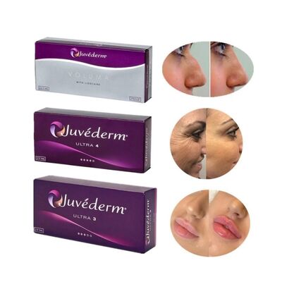 Juvederm Penuh Kulit Injeksi Berkualitas Panjang 2 Tahun