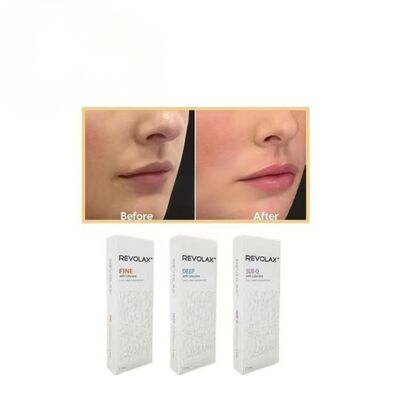 Pengisi Dermal Revolax Sub-Q Dalam Halus Menampilkan Konsistensi Gel Halus dan Elastis untuk Restorasi Volume Wajah yang Terlihat Alami