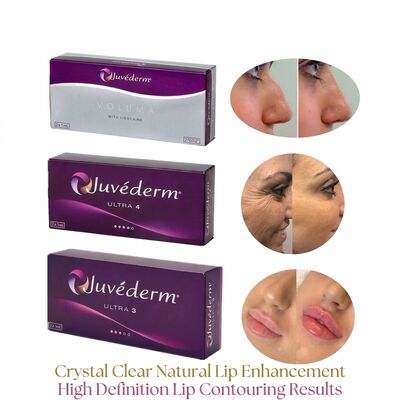 Volume Jarum Suntik 2 1Ml Per Kotak Juvederm Pengisi Voluma Pengisi Dermal Suntik Kontur Wajah Aman untuk Peningkatan Volume
