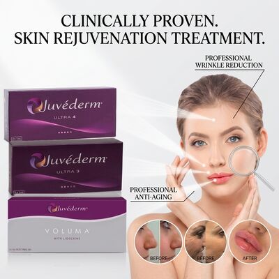 Juvederm Ultra 3 Nasolabial Fold Filler Asam Hyaluronic Filler Kulit untuk Merataikan Garis-garis Senyum 24mg/ml
