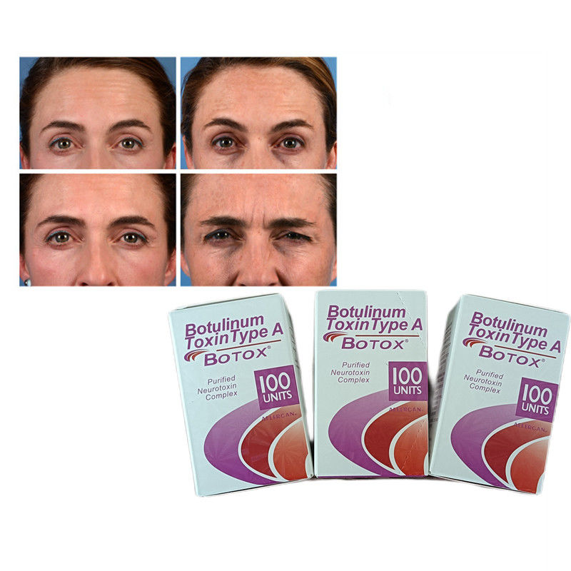 100U/vial Botulinum Toxin Tipe A Anti-Wrinkle  Powder