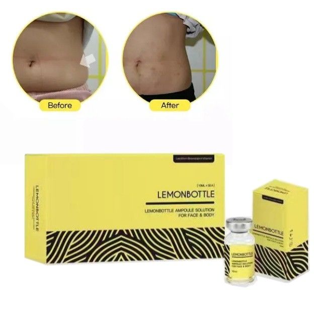 Solusi Botol Lemon Konsentrasi Tinggi Untuk Injeksi Larut Lemak 5 Vial X 10ml Seluruh Tubuh