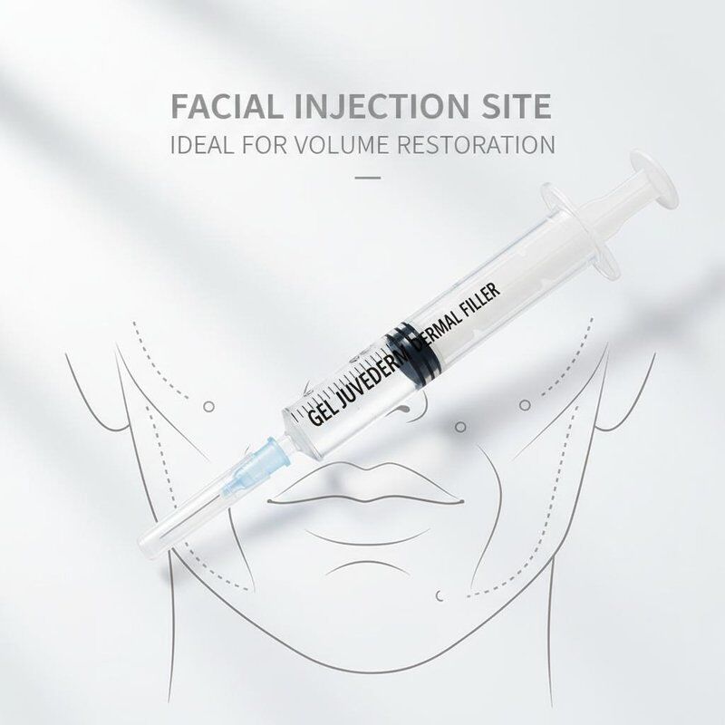 Gel Juvederm Dermal Filler 1ml Jarum Suntik Tempat Injeksi Wajah Ideal untuk Prosedur Peremajaan Wajah dan Pemulihan Volume